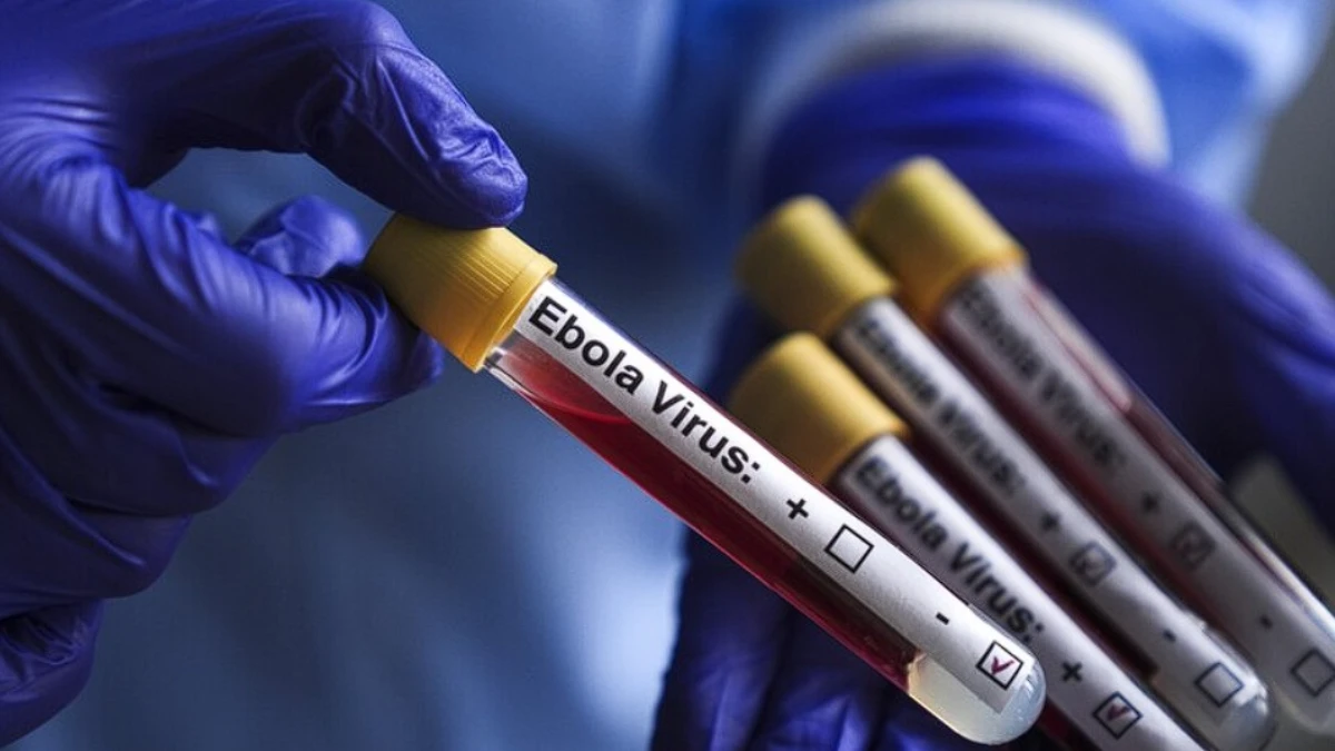 DS&Ouml;&rsquo;den Ebola salgını a&ccedil;ıklaması: Seyahat ve ticaret kısıtlaması &ouml;nerilmiyor
